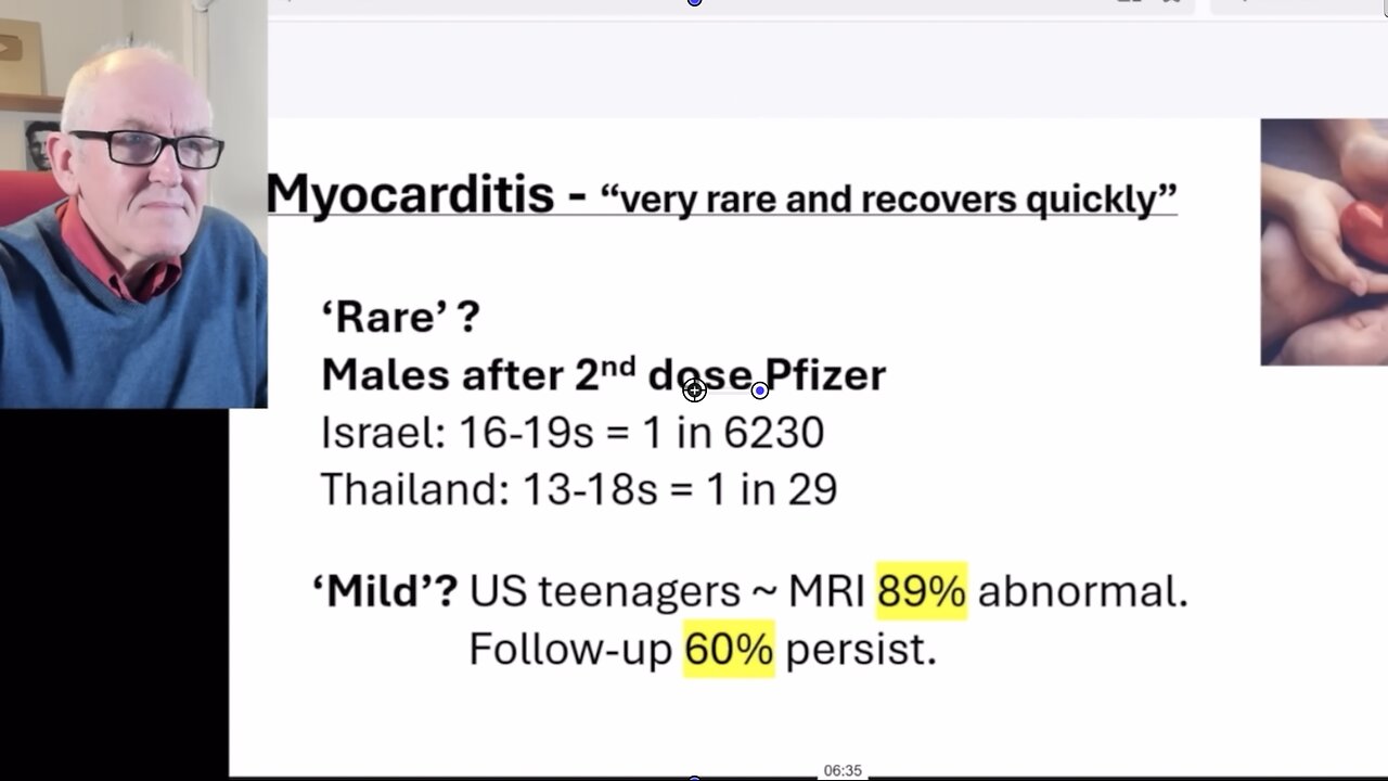 Dr Ros Jones - After 2 Doses of Pfizer Vaccine, 1 in 29 (13-18 yr old) Males Got Myocarditis