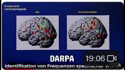 Die drahtlose Gehirn Computer Schnittstelle der DARPA, die Nanotech & KI nutzt, ist das neue MKULTRA
