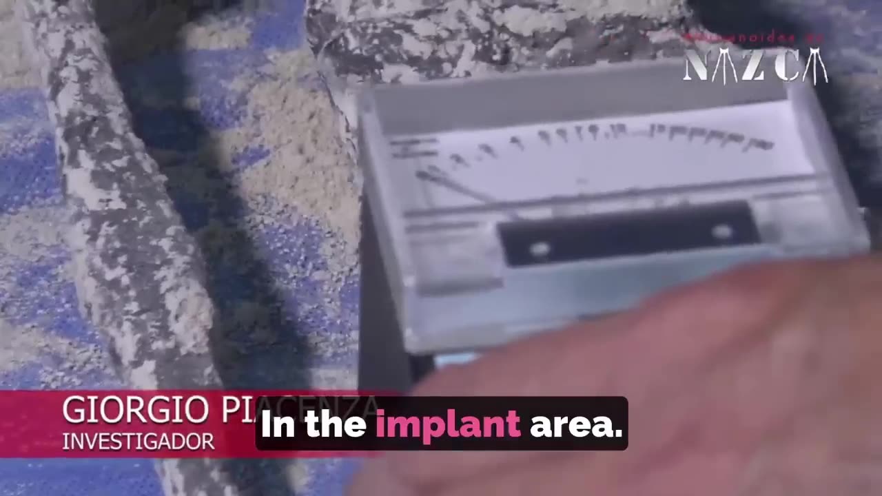 🤔💡 The Alien Implants: What's the Truth Behind the Signal? | TheTruthAbove