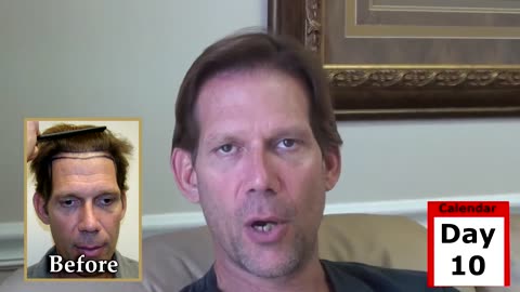 Dr. Brett Bolton | Follow a World-Renowned Hair Transplant Consultant Undergo a Hair Transplant