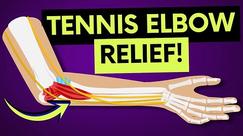 Fix Elbow Pain Fast, No Gimmicks! (Tennis Elbow)
