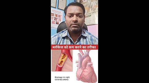 ब्लॉकेज को कम करने का तरीका ।