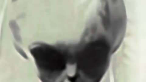 👽🤯 The Bizarre Skinny Bob Case EXPOSED! UFO Encounter Mystery | TheTruthAbove