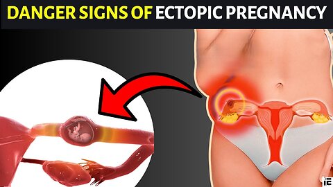 Understanding Ectopic Pregnancy: Know the Warning Signs