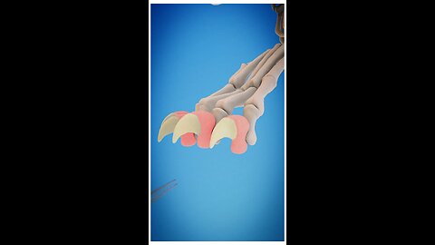 Don't Declaw Your Cat😰 #Fact #treingshort