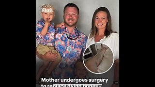 Woman's bones 🦴 dying from the VACCINE