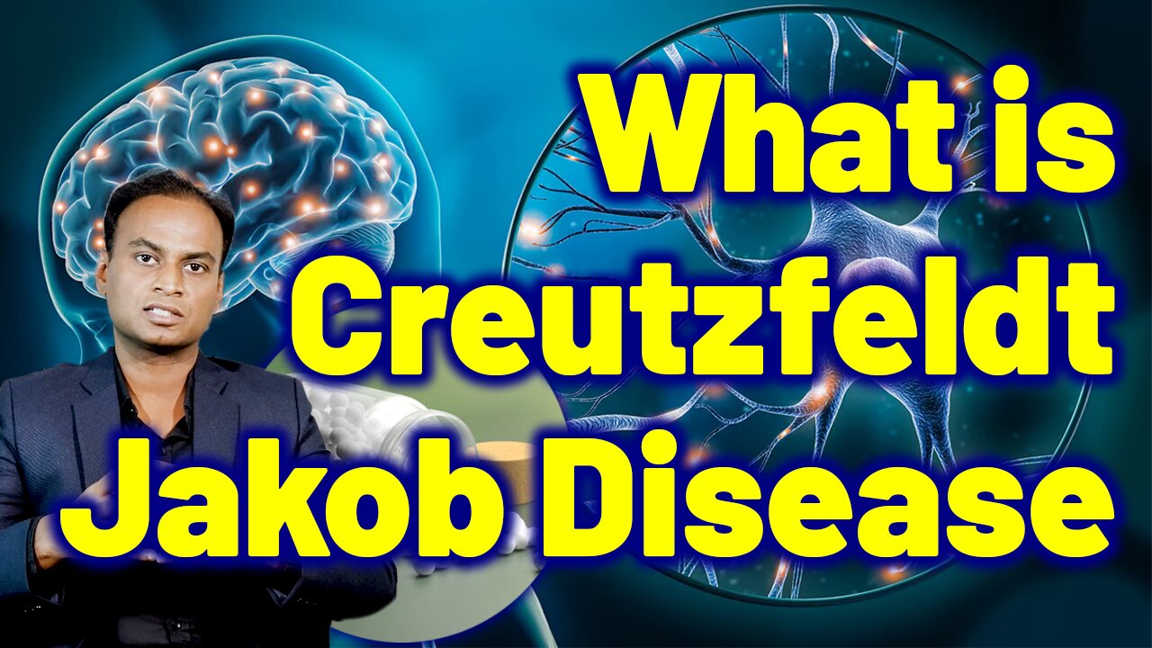 What is Creutzfeldt Jakob Disease Prions Disease MadCow Disease Chronic Wasting Disease? Neurology