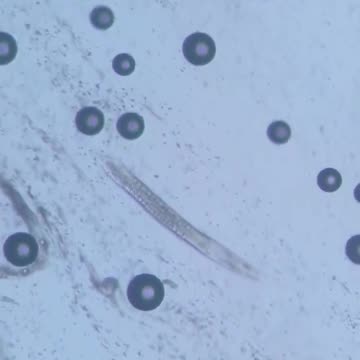 Pineapple Juice vs Parasites