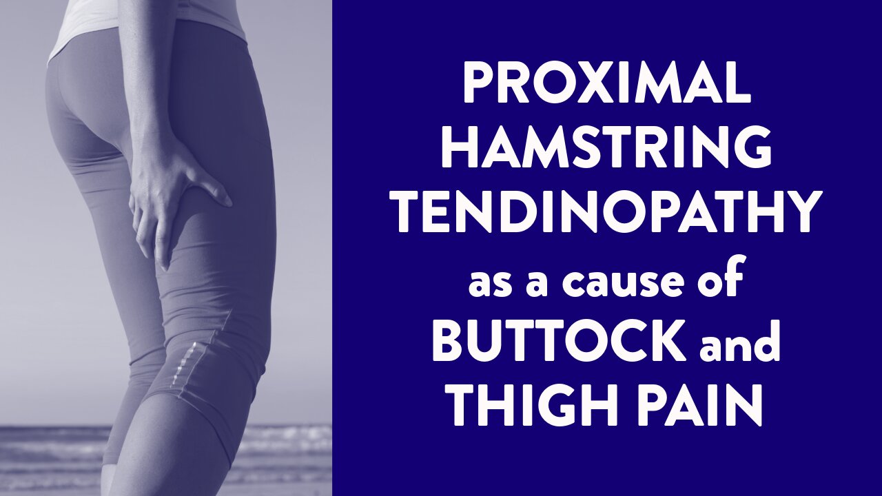 Proximal hamstring tendinopathy as a cause of buttock and thigh pain
