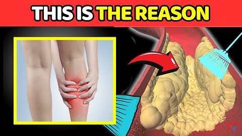 "You’re KILLING Your LEG CIRCULATION Without Knowing"! 4 Shocking SILENT CAUSES