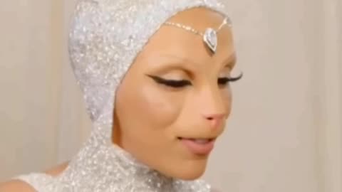 Celebrity plastic surgery disasters