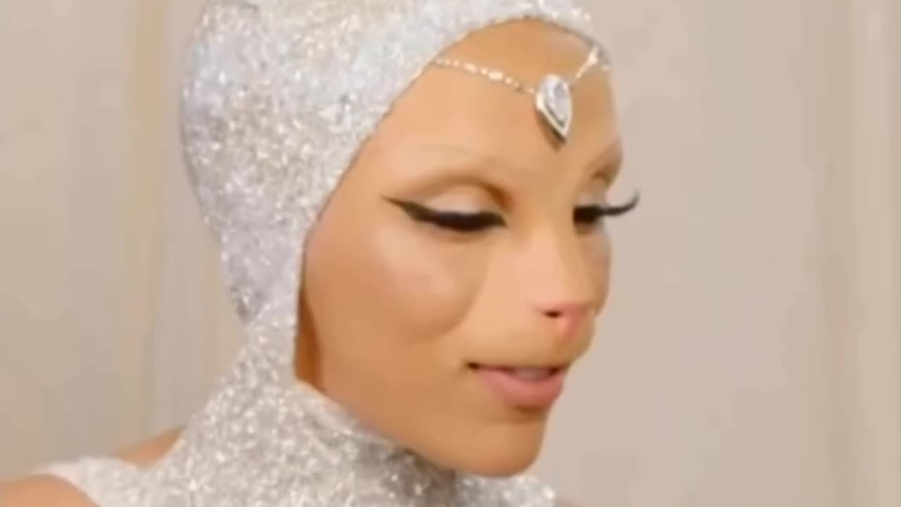 Celebrity plastic surgery disasters