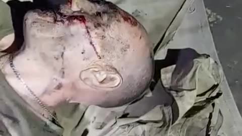 Drunk Russian Soldier Blown Up While Fumbling Around with Grenade
