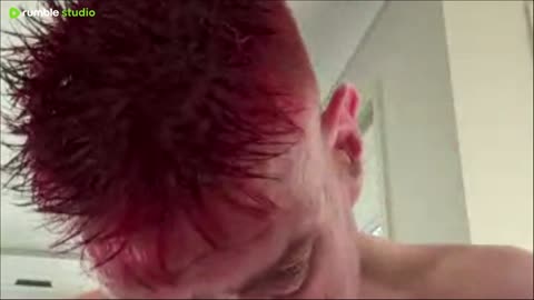 Everyone has insecurities its called being a human