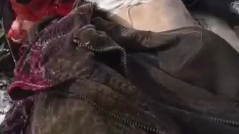 Wounded Russian Soldier Told to Get Up and Walk