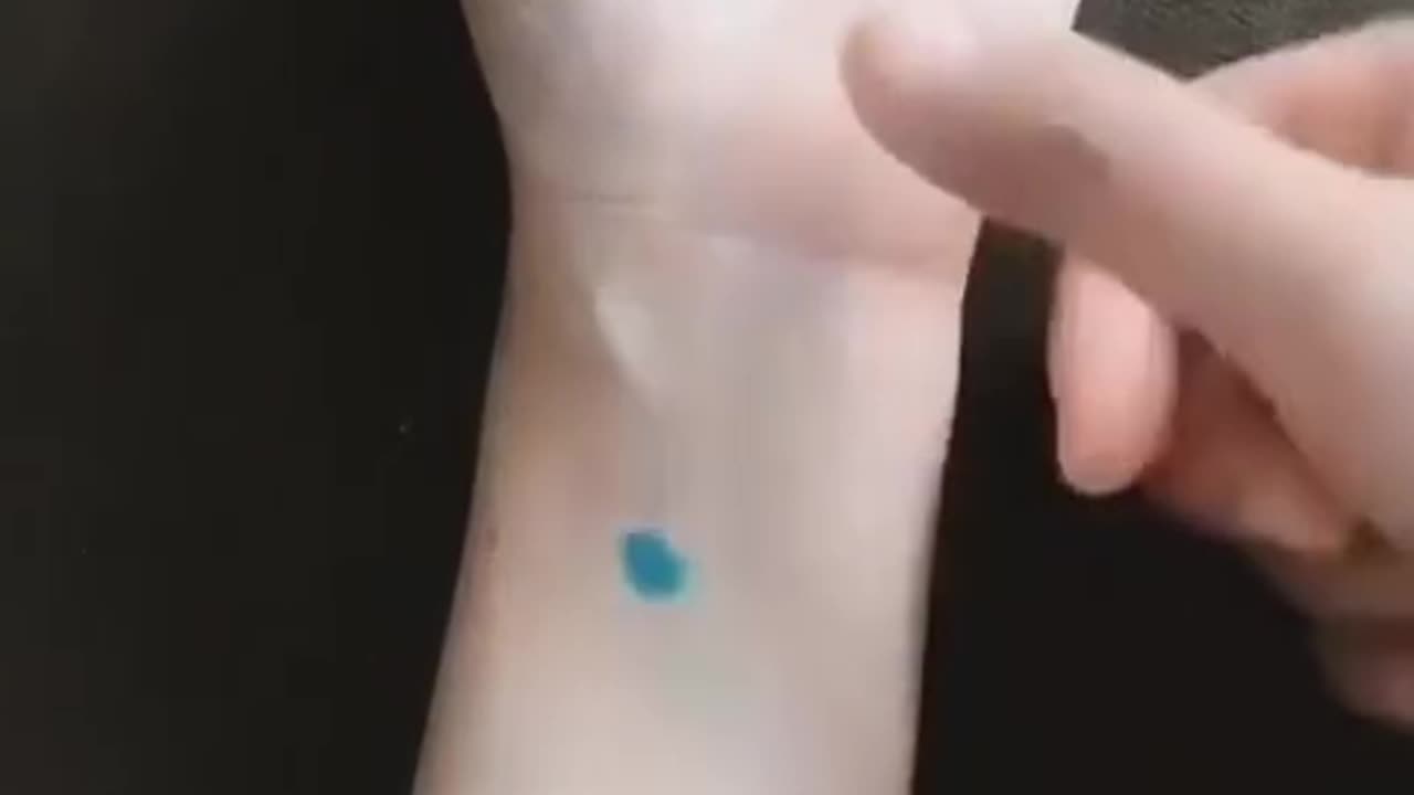 The magic acupuncture points