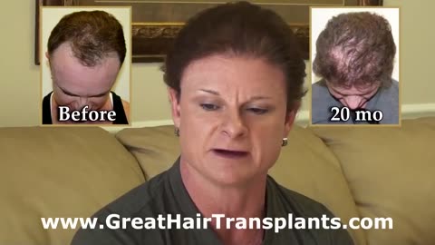 Amazing Female Hair Transplant Transformation by Dr. Brett Bolton