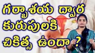 గర్భాశయ ద్వార కురుపుకి చికిత్స | Best Homeopathy Treatment For Nebothian Cyst | Cervix Cyst Cure