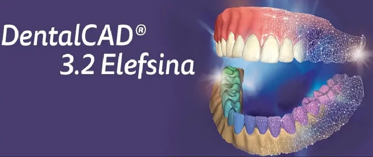 Exocad 3.2 Full 2026 ✅️ DOWNLOAD