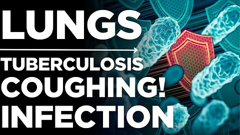 Tuberculosis: How TB Spreads & How to Stay Safe | Medickpidia