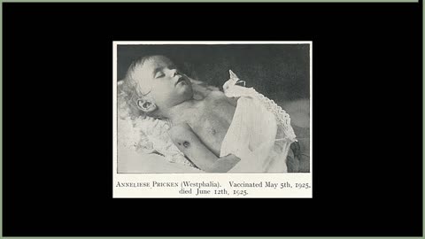 Chapter 2 — The Golden Calf: An Exposure of Vaccine Therapy by Charles W. Forward audiobook