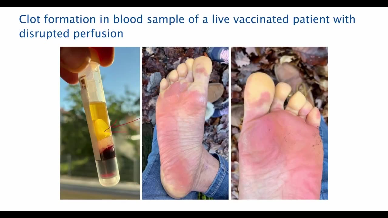 We were right about covid and the vaccine in the summer of 2020!