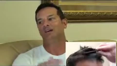 Real Hair Implant Testimonial | Dr. Brett Bolton Patient Shares His Results