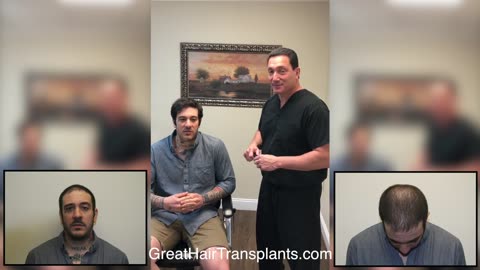 Dr. Brett Bolton Patient Marc MaxHarvest™ Plus Hair Transplant