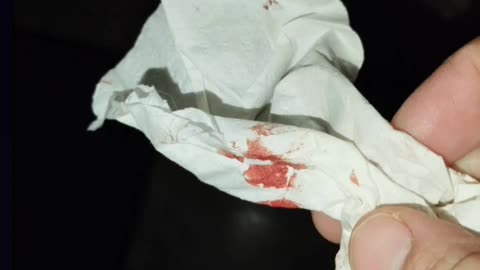 Aparecen manchas de sangre en el portal