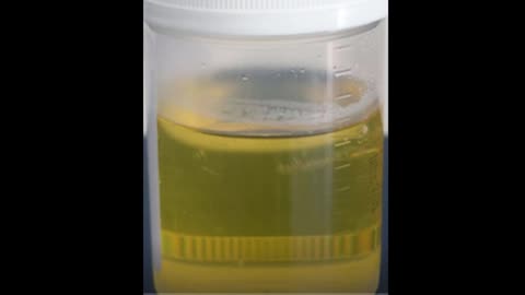 First Morning Pee Smells Like Citrus