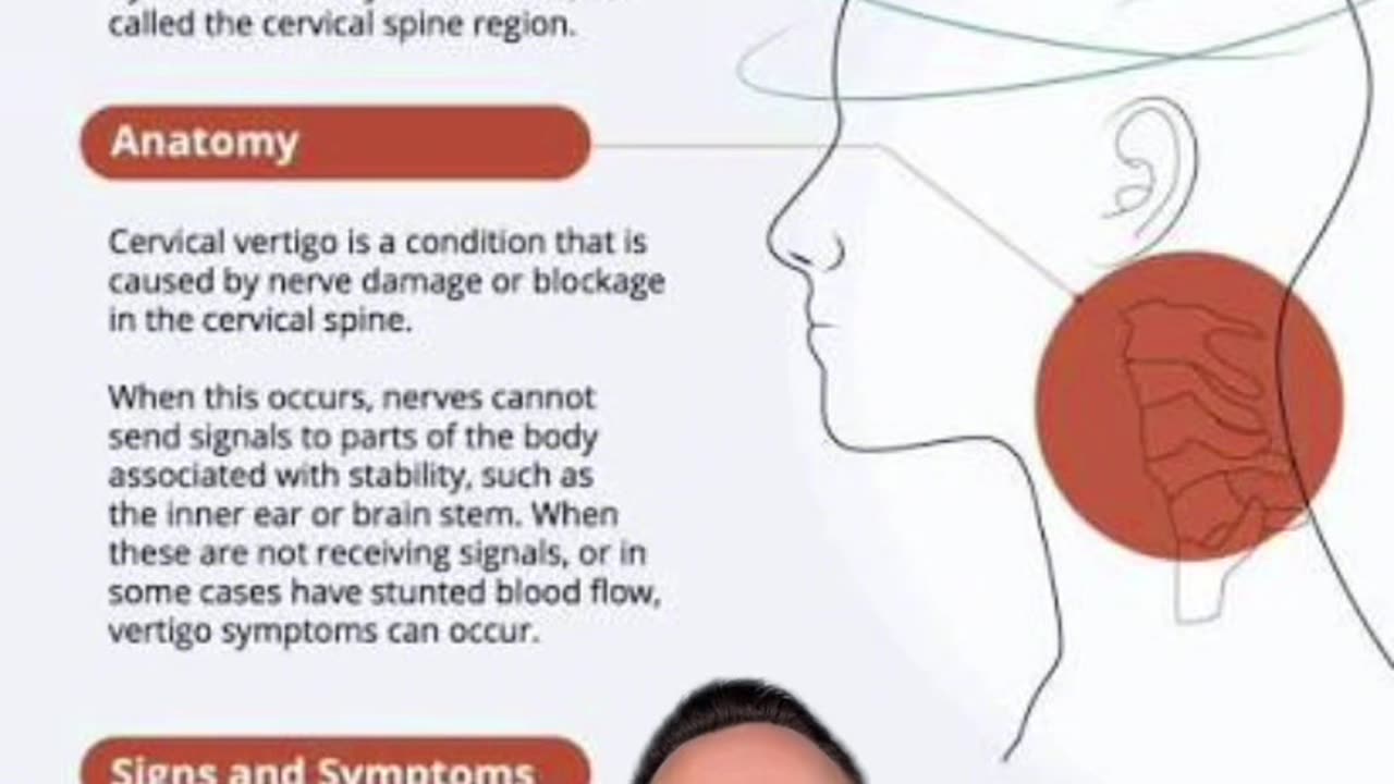 Cervicogenic vertigo | Natural Vertigo Doctor | Neckwise