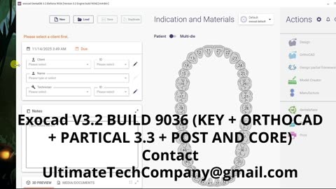 ExoCAD V3.2 KEY + ORTHOCAD + PartialCAD 3.3 Download 2026