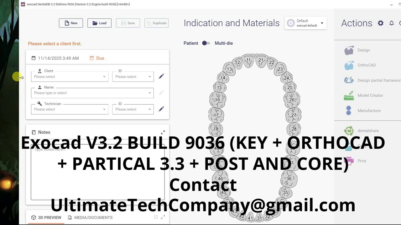 ExoCAD V3.2 KEY + ORTHOCAD + PartialCAD 3.3 Download 2026