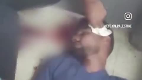 Palestinian nurse reportedly SHOT IN HEAD by IDF