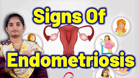 Signs and Symptoms Of Endometriosis | Uterine Lining Disorder | Treatment Homeopathy Medicine & Cure