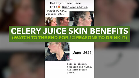 Celery Juice Skin Benefits—Watch To The End For 12 Reasons To Drink It
