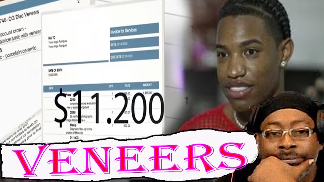 Man Pays $11,000 for Veneers