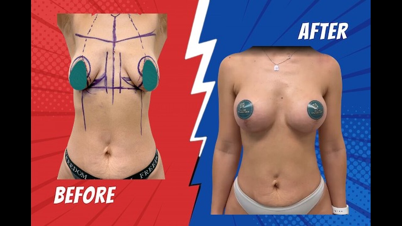 Plastic Surgery Truths | Asymmetries, Scars & Real Results Explained by Dr. Samir Ahire