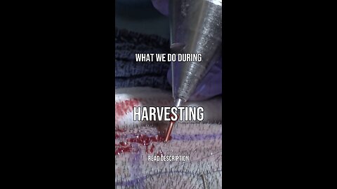 HOW WE DO HARVESTING