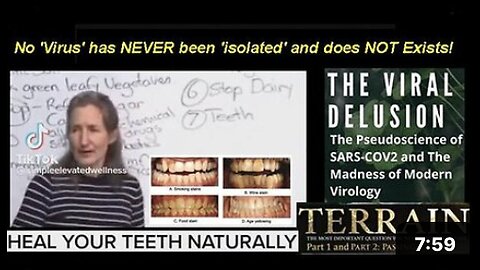 Hey 'Barbara O'Neill' (Australia): What if I have a 'Root Canals' in my 'Teeth'?