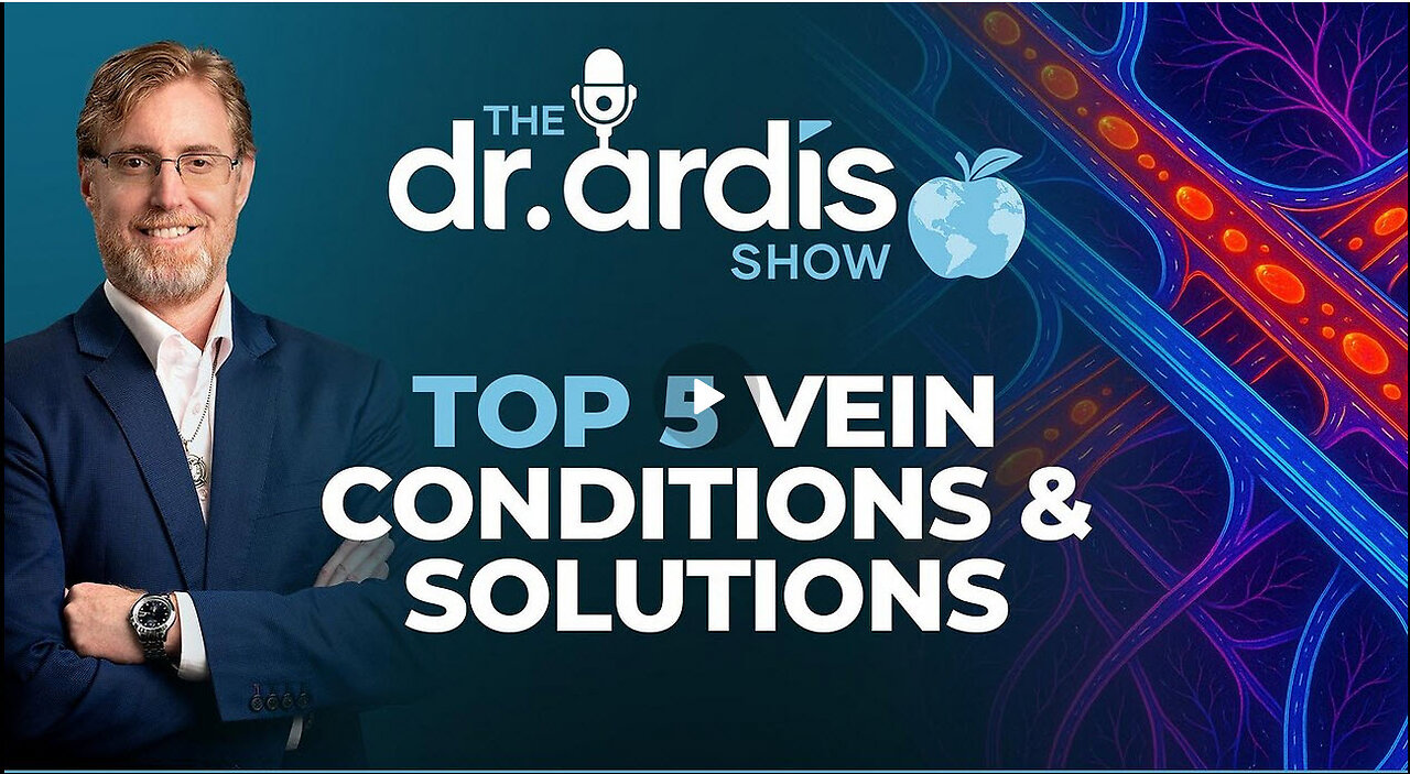 The Dr. Ardis Show | Top 5 Vein Conditions & Solutions | Episode 11.19.2025