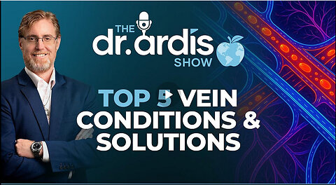 The Dr. Ardis Show | Top 5 Vein Conditions & Solutions | Episode 11.19.2025
