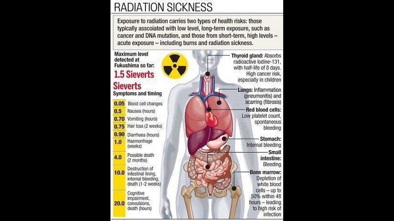Radiation Detox Formula: A Simple Solution for Cleansing Your System