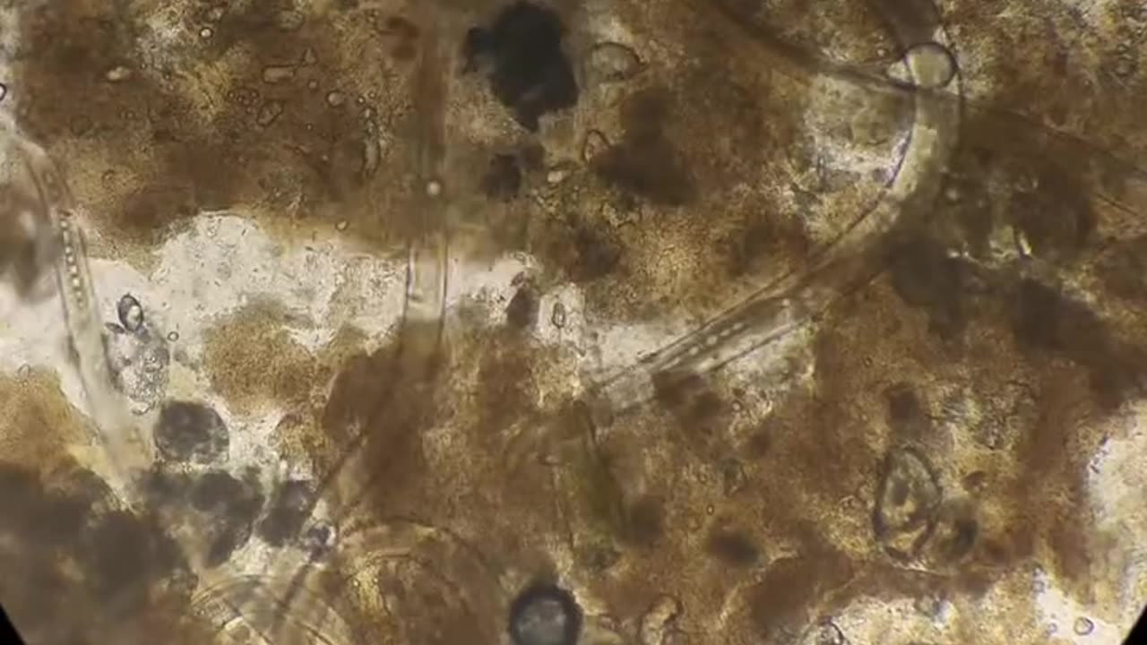 Ever wonder what happens to raw milk under microscope