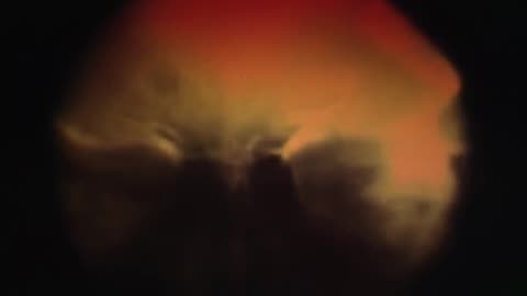 DISMEMBER - Dreaming In Red (OFFICIAL MUSIC VIDEO)