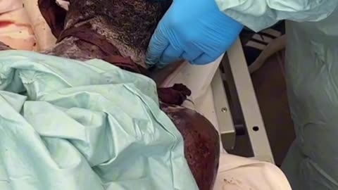 Arrival of 15 bodies and remains of Palestinian martyrs at the Nasser Medical Complex (Graphic)