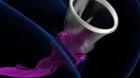 Hysterectomy Procedure 3D Animation