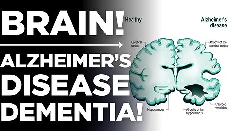 Alzheimer’s Disease: Affects Memory & Brain Function🤯 | Medickpidia