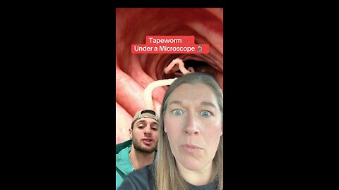 Tapeworms under microscope