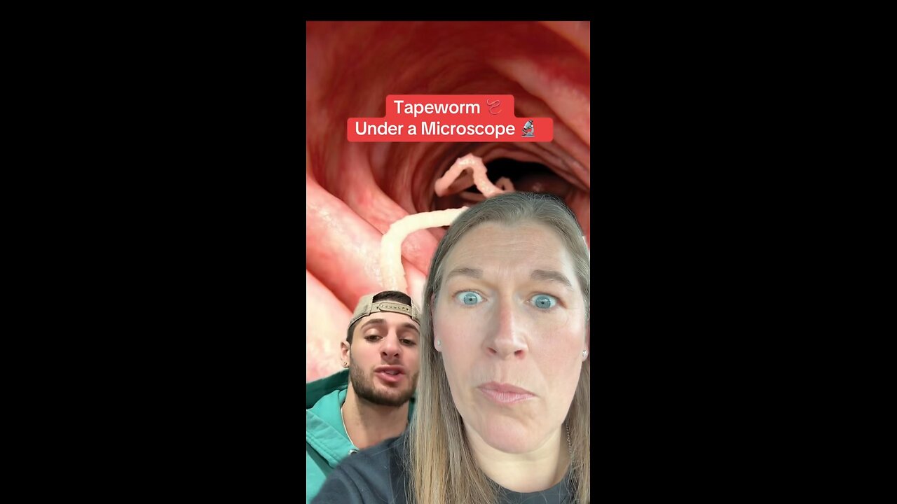 Tapeworms under microscope